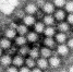 Norovirus - Vyborg.TV
